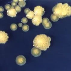 Enterobacter cloacae: Częste objawy i leczenie infekcji