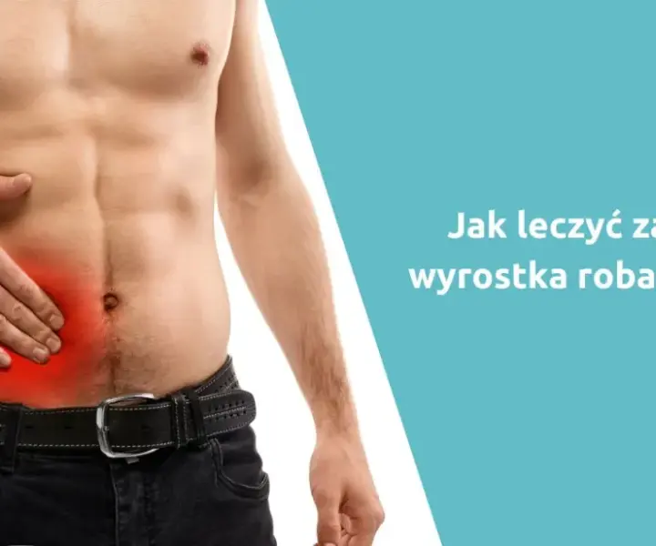 Jak złagodzić ból wyrostka robaczkowego i kiedy szukać pomocy